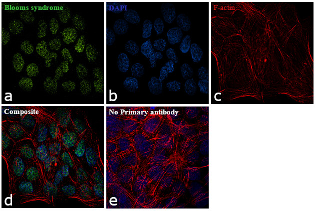 Blooms Syndrome Antibody in Immunocytochemistry (ICC/IF)