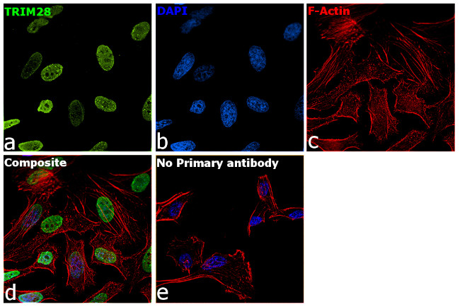 TRIM28 Antibody in Immunocytochemistry (ICC/IF)