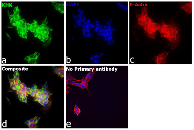 KHK Antibody in Immunocytochemistry (ICC/IF)