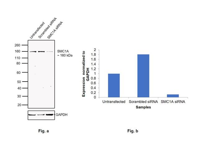 SMC1 Antibody in Western Blot (WB)