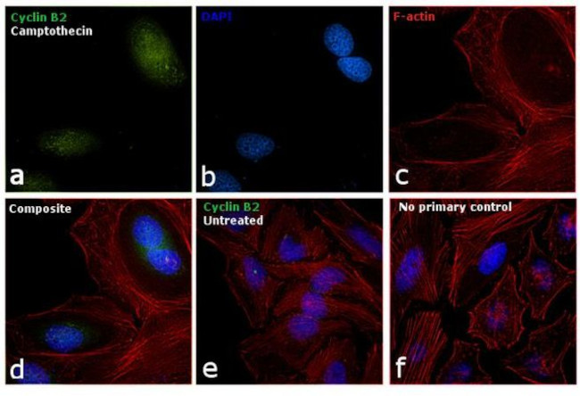 Cyclin B2 Antibody in Immunocytochemistry (ICC/IF)