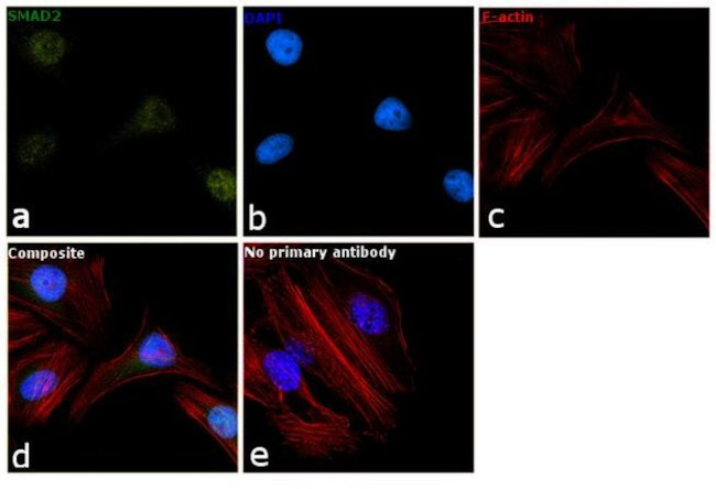 SMAD2 Antibody in Immunocytochemistry (ICC/IF)