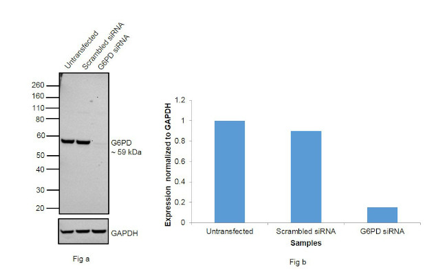 G6PD Antibody