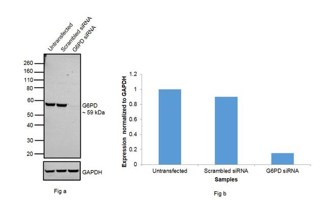 G6PD Antibody in Western Blot (WB)