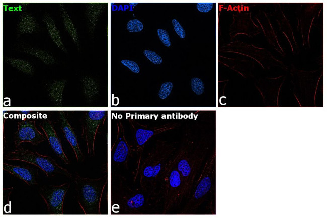 PBX1 Antibody in Immunocytochemistry (ICC/IF)