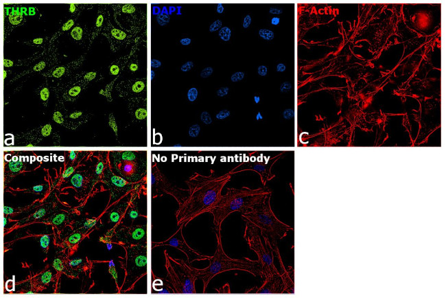 THRB Antibody in Immunocytochemistry (ICC/IF)