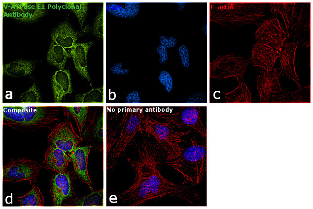 V-ATPase E1 Antibody in Immunocytochemistry (ICC/IF)