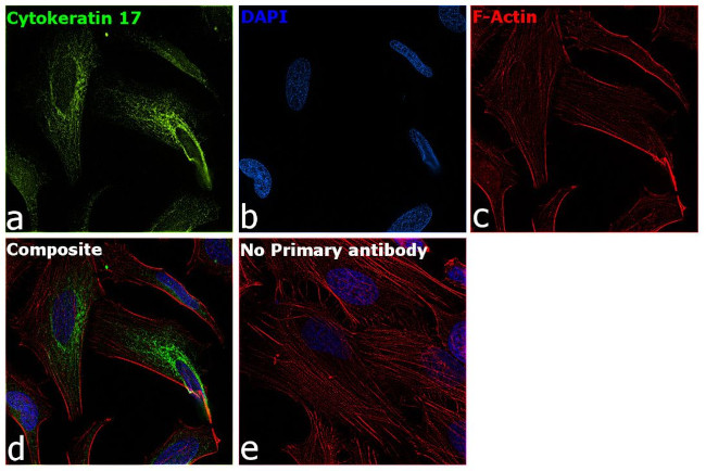 Cytokeratin 17 Antibody in Immunocytochemistry (ICC/IF)