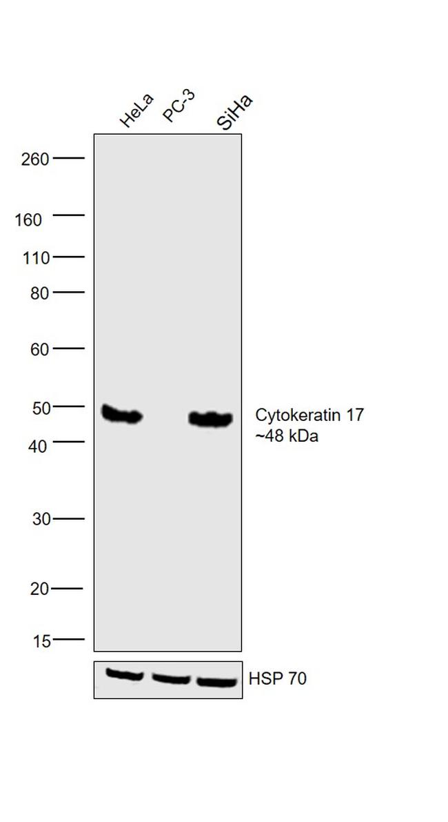 Cytokeratin 17 Antibody in Western Blot (WB)