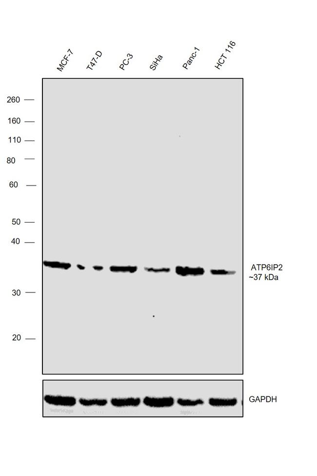 ATP6IP2 Antibody in Western Blot (WB)