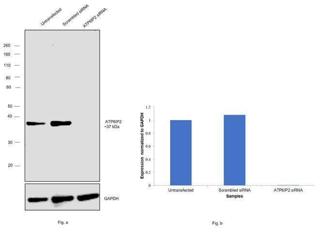 ATP6IP2 Antibody in Western Blot (WB)