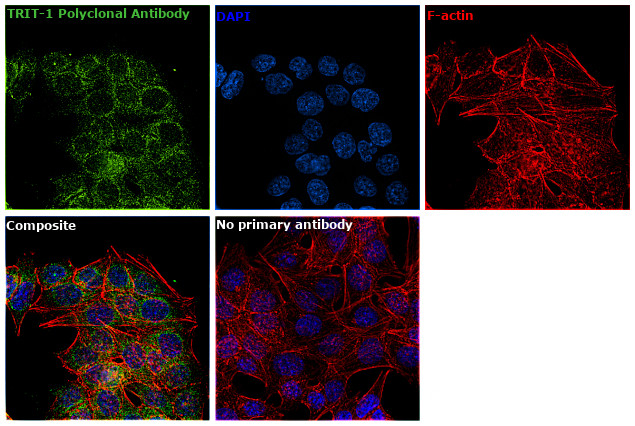 TRIT1 Antibody in Immunocytochemistry (ICC/IF)