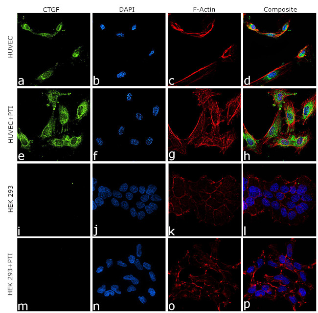 CTGF Antibody in Immunocytochemistry (ICC/IF)