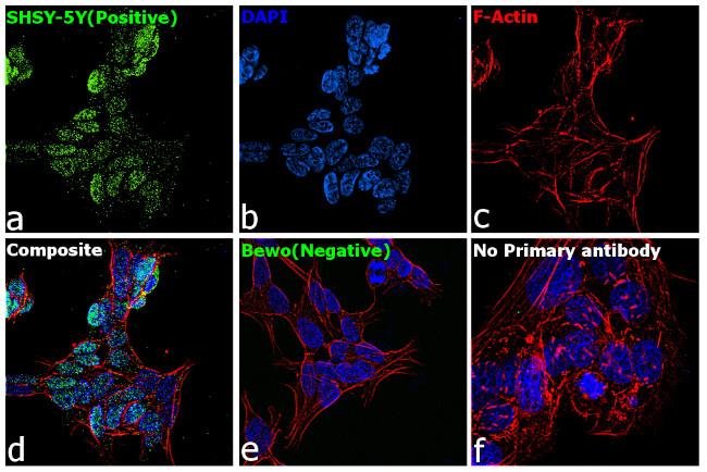 SOX11 Antibody in Immunocytochemistry (ICC/IF)