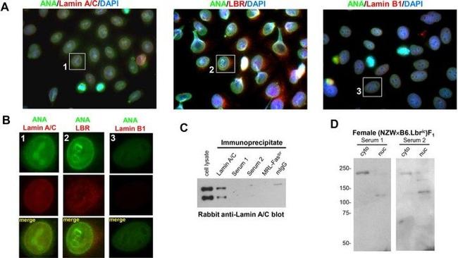 Lamin B Receptor Antibody in Immunocytochemistry (ICC/IF)
