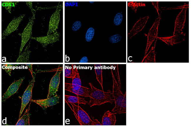 CD51 Antibody in Immunocytochemistry (ICC/IF)