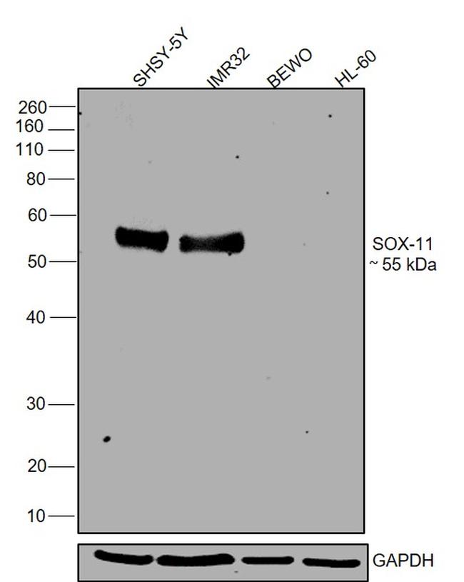 SOX11 Antibody in Western Blot (WB)