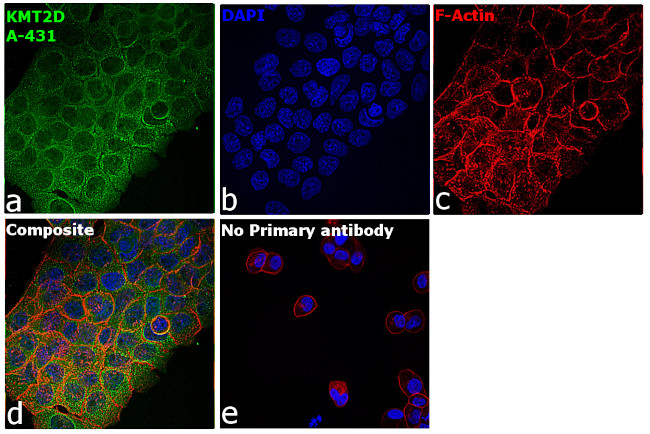 KMT2D Antibody in Immunocytochemistry (ICC/IF)