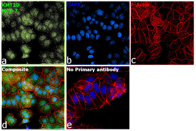 KMT2D Antibody in Immunocytochemistry (ICC/IF)