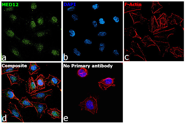 MED12 Antibody in Immunocytochemistry (ICC/IF)