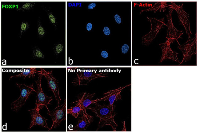 FOXP1 Antibody in Immunocytochemistry (ICC/IF)