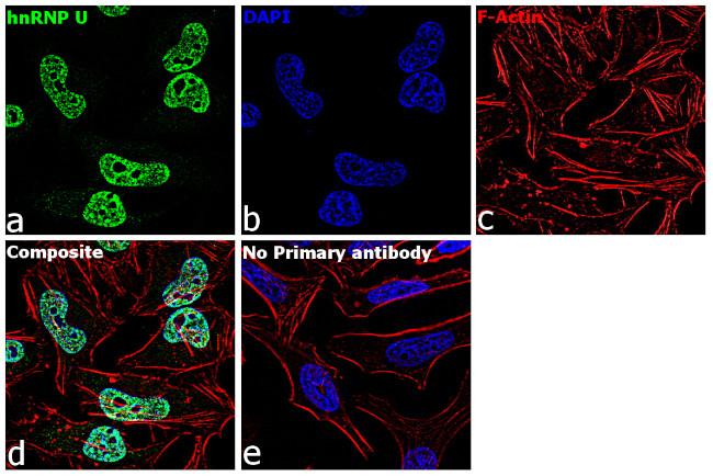 hnRNP U Antibody in Immunocytochemistry (ICC/IF)