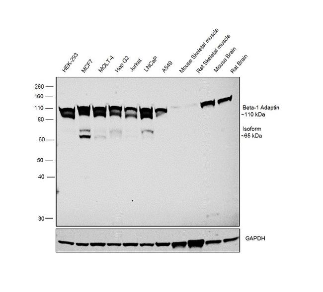 beta-1 Adaptin Antibody in Western Blot (WB)