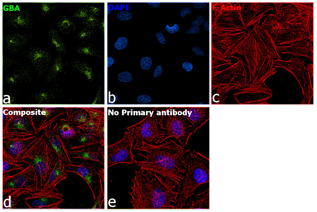 GBA Antibody in Immunocytochemistry (ICC/IF)