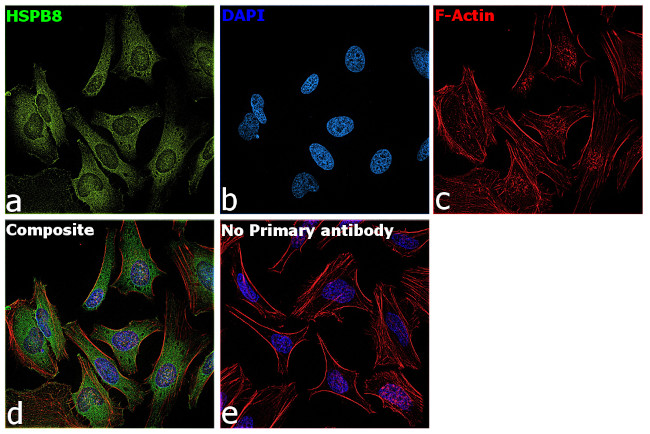 HSPB8 Antibody in Immunocytochemistry (ICC/IF)