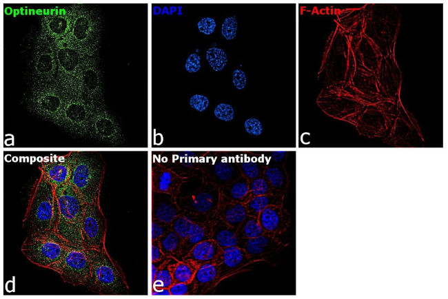 Optineurin Antibody in Immunocytochemistry (ICC/IF)