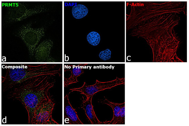PRMT5 Antibody in Immunocytochemistry (ICC/IF)