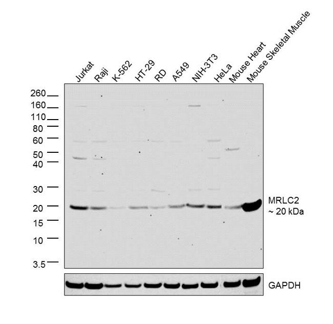 MRLC2 Antibody in Western Blot (WB)