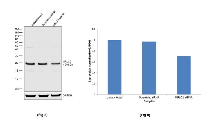 MRLC2 Antibody in Western Blot (WB)