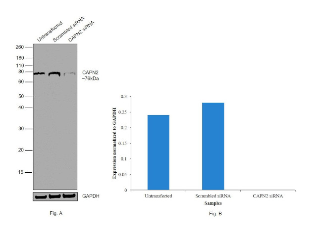 Calpain 2 Antibody