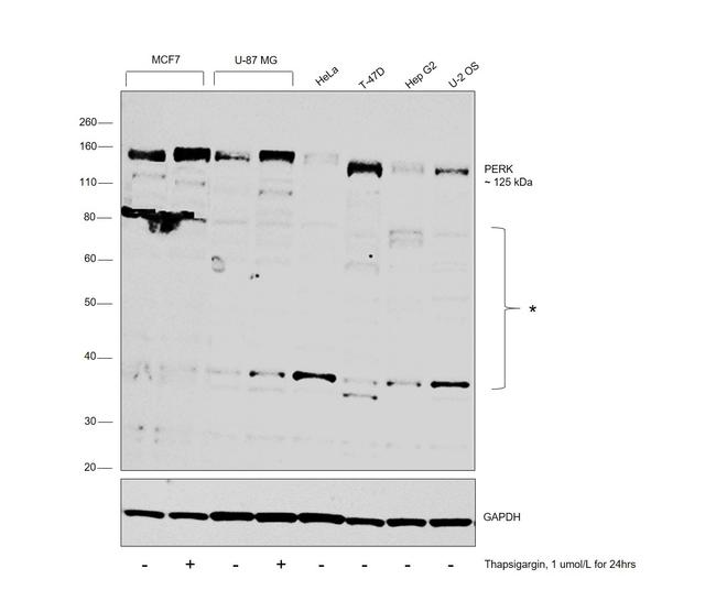 PERK Antibody in Western Blot (WB)