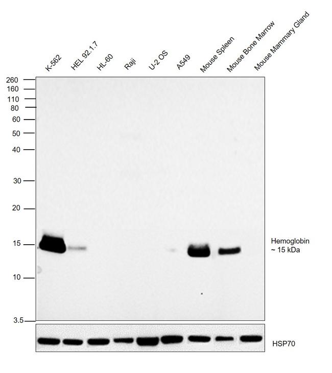 Hemoglobin alpha Antibody in Western Blot (WB)