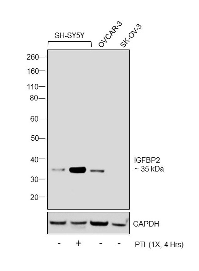 IGFBP2 Antibody