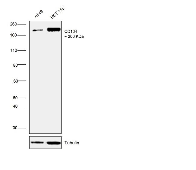 CD104 (Integrin beta 4) Antibody in Western Blot (WB)