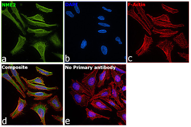 NME2 Antibody in Immunocytochemistry (ICC/IF)