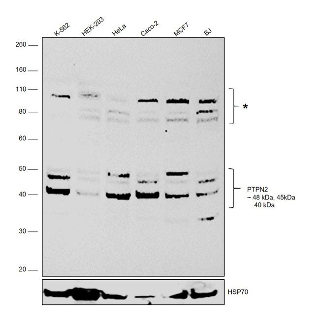 PTPN2 Antibody in Western Blot (WB)