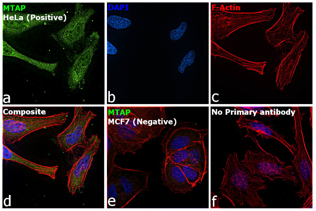 MTAP Antibody in Immunocytochemistry (ICC/IF)