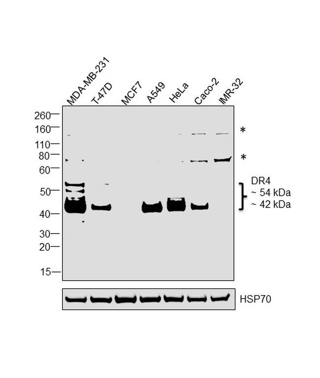 DR4 Antibody in Western Blot (WB)