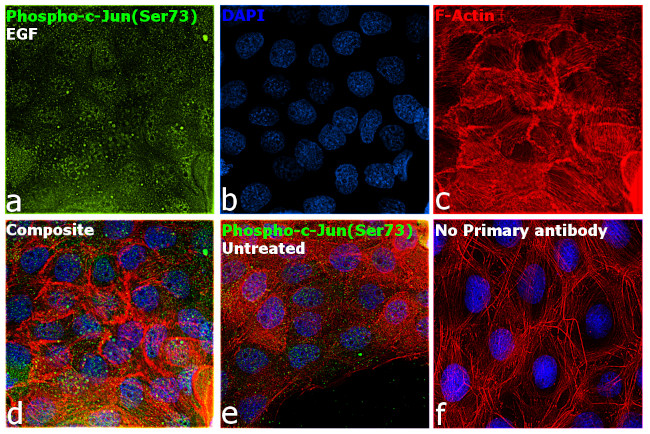 Phospho-c-Jun (Ser73) Antibody in Immunocytochemistry (ICC/IF)