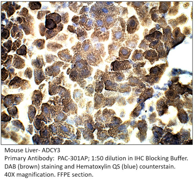 ADCY3 Antibody in Immunohistochemistry (IHC)