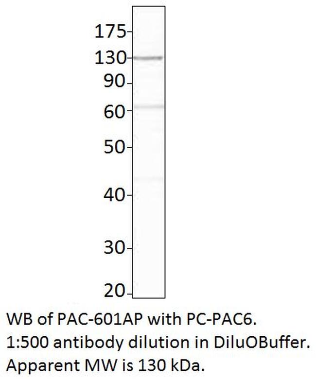 ADCY6 Antibody in Western Blot (WB)