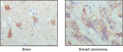 PAR4 Antibody in Immunohistochemistry (Paraffin) (IHC (P))