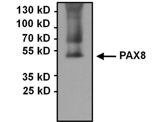 PAX8 Antibody in Immunoprecipitation (IP)