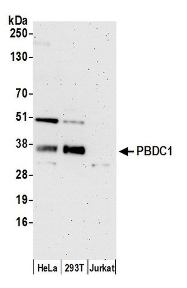 PBDC1 Antibody in Western Blot (WB)