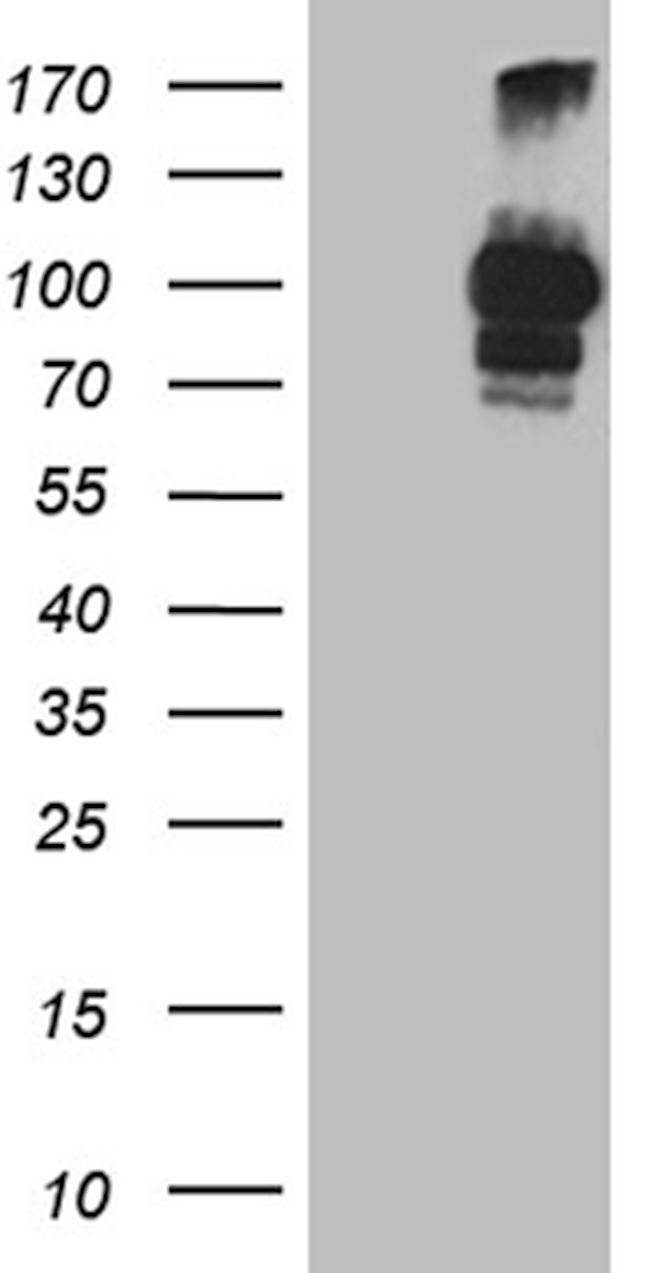 PCSK9 Antibody in Western Blot (WB)