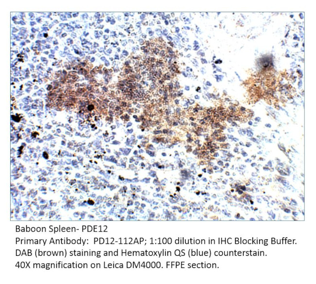 PDE12 Antibody in Immunohistochemistry (IHC)